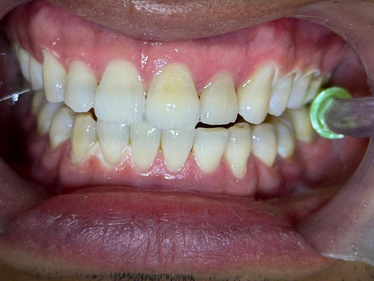 Transforma Tu Sonrisa en Cali
